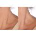Nakery SkinToning Body Butter | Crepe Smoothing + Repair | Niacinamide, Caffeine, Tri-Hyaluronic Acid | Social Butterfly - Buy Online on GoSupps.com