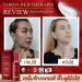 Vorda Red Therapie Serum Facial 30ml - Korean X50 Photoglow for Radiant Skin | International Shipping - Buy Online on GoSupps.com