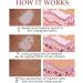 FOIDL Vitiligo Relief Spray & Skin Care Cream - Improve Skin Pigmentation & Regulate Vitiligo - White Pigmentation Treatment - Buy Online on GoSupps.com