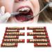 Buy Complete Resin Dentures | High-Quality Artificial Teeth & Dental Supplies for International Shipping - Buy Online on GoSupps.com