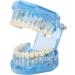 Adult Dental Implant Tooth Model - Blue-Transparent Acrylic for Pedagogical Demonstration | Removable Simulation for Dentists - Buy Online on GoSupps.com