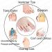 Silicone Gel Big Toe Cap (2PAIR) - Toe Sleeve for Missing or Ingrown Toenails - Prevents Corns/Callus & Blisters - Avoid Toe Friction Injury - Unisex - Foot Care (for Small Toe) by PEDIMEND - Buy Online on GoSupps.com