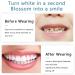 Second Gen Silicone Fake Braces Set for Upper and Lower Teeth Simulation - Snap On Smile & Teeth Whitening Option - Buy Online on GoSupps.com