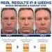 Openeyes Awaken Peptide Lifting Eye Gel for Men - 5Pcs | Reduce Fine Lines, Dark Circles & Wrinkles | Retinol Eye Cream for Anti-Aging & Depuffing - Buy Online on GoSupps.com
