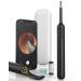 Ear Wax Removal Tool  Ear Cleaner with Portable Storage Box  300W Pixel 1080P Ear Camera  Earwax Removal Kit with 6 LED Lights  Non-Detachable Ear Scoop for Safe Ear Pick
