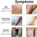 Japagzy Marrony Oil for Varicose Veins - Healing Spray Treatment (10ml 3 Box) | Effective Vein Care Solution - Buy Online on GoSupps.com