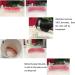Buy Frenzify 2 Pairs of Provisional Dentures | Temporary Prostheses & Whitening Veneers for Men & Women International Shipping Available - Buy Online on GoSupps.com