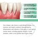 Gum Regrowth Drops 30ML Gum Regrowth Treatment Drops Rejuvenate Your Gums with Ease Repair Gum Regrowth for Receding Gum - Buy Online on GoSupps.com