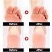 Urea Cream Urea 42% Foot Cream Ultra Moisturizing Heel Balm For Callus Removal and Soften Cracked Heel Repair Cream for Dry Skin Urea Lotion for Feet Hand & Body Maximum Strength - Buy Online on GoSupps.com