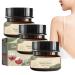 pathside Flysmus KeratosisTreat Deep Clean Smooth Cream Keratosis Treat Deep Clean Smooth Cream Keratosistreat Cream keratosis pilaris treatment cream Suitable for Rough and Bumpy Dry Skin (3pc)