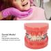Buy GFRGFH Dental Model with 24 Teeth - Half Metal Half Ceramic Bracket for Teaching & Study - International Shipping Available - Buy Online on GoSupps.com