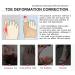 2 Pairs Soft Breathable Toe Separator Sleeves with Gel Spacer for Big Toe Alignment and Pain Relief - Hammer Toe Corrector for Bunions and Overlapping Toes (Size S) - Buy Online on GoSupps.com