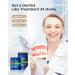 Non-Slip Teeth Whitening Strips for Sensitive Teeth - 9 Treatments, 30mins to Remove Stains - 18 Strips/Pack - Buy Online on GoSupps.com