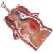 Hemorrhoid Lesion Model Human Rectal Pathological Anatomy Model Internal Model of Hemorrhoids External Model of Hemorrhoids Anal Model Tool Teaching - Buy Online on GoSupps.com