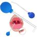 JIEJIEHOUSE Tonsil stone remover tonsil stone removal tool tonsil stone cupping glass combat bad breath effective mouth cleaning for fresher breath with 15 glass suction pipette and - Buy Online on GoSupps.com