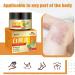 Sensitive Skin Natural Eczema Treatment Cream - Steroid & Fragrance-Free Psoriasis Relief - Anti-Itch & Moisturizing Formula - 1.06oz - Buy Online on GoSupps.com