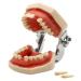 BuTkus Dental Teaching Tooth Model Removable Tooth Preparation Implant Practice Soft Gums 28 Resin Teeth
