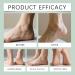 Spray Exfoliant Pour Les Pieds Masque Hydratant Instantan Naturel Pour Les Pieds Exfolie En Douceur La Peau Rugueuse Et S Che. (2pcs) 100 g (Lot de 1) - Buy Online on GoSupps.com