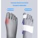 ALINZO Bunion Corrector - Orthopedic Big Toe Separator for Pain Relief - Non-Surgical Hallux Valgus Correction - Day & Night Support (Blue) - Buy Online on GoSupps.com