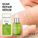 Allayu Leg Chest Stretch Mark Removal Serum Body Burn Scars Serum Girls Repair Essence Beauty Supplies - Buy Online on GoSupps.com