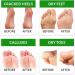 FC Fancy Foot Peeling Mask - 3 Pairs | Natural Exfoliating Socks for Baby Soft Feet | Lavender Rose & Chamomile | Cornea Removal for Men & Women - Buy Online on GoSupps.com