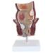 Medical Science Rectum Fissure Lesion Model 5X Human Pathology Model Hemorrhoid Anal Fistula Medical Organ Model
