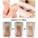 BOMPOW Electric Callus Remover - Rechargeable Foot File for Cracked Heels and Dead Skin - Buy Online on GoSupps.com