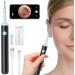 Rorodoto XIMGirl Ear Wax Removal Tool with Camera - 1080p Wireless Ear Cleaner & Silicone Spoon for iPad & Android - Safe & Effective Ear Wax Removal for Adults (Black) - Buy Online on GoSupps.com