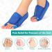 Hallux Valgus Rail - 3D Printed Bunion Splint with Arch Support | Nighttime Toe Straightener & Hammer Pain Relief - Buy Online on GoSupps.com