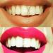 FIVENUM Hip Hop Gold Teeth Crystal Grills - Dental Mouth Caps for Cosplay & Parties | Funny Jewelry Gift for Rappers - Buy Online on GoSupps.com