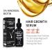 MINOXIDIL 5% Hair Growth Serum with Biotin & Collagen for Men - Hair Regrowth & Loss Treatment - Buy Online on GoSupps.com