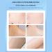 Cracked Heel Cream Softening Ointment 100g - Lotion For Dryness And Cracks | Quickly Softens Hard Skin Prevents Recurrent Dryness For Feet - Buy Online on GoSupps.com