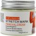 Belly Mark Cream Pregnancy Stretch Mark Lotion Fast Absorbing Formula Smoothing Skin Solution 100g Tube Hydration Excellent for Travel Business Trips Home Use - Buy Online on GoSupps.com