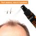SEVICH Hair Growth Essence Spray 30ml - Prevent Hair Loss & Thinning - Scalp Improvement - Fragrance-Free Hair Care for Men & Women - Buy Online on GoSupps.com
