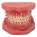 Orthodontic Demonstration Model for Dental Research | Metal Wires & Ceramic Brackets | Teaching Aids for Adults - Buy Internationally - Buy Online on GoSupps.com