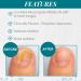 Nail Tek Maximum Strength Antifungal Solution - Clinically Proven for All Nail Types - 0.33 oz 1-Pack - Buy Online on GoSupps.com