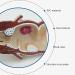 Human Rectal Hemorrhoid Lesions ical Model Colon Anal Sphincter Anorectal Teaching Specimen - Buy Online on GoSupps.com
