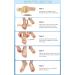 Ailaka Arch Support Braces for Plantar Fasciitis - Adjustable Compression Bands with Gel Pad for Flat Foot Pain Relief - Beige, Various Sizes - Buy Online on GoSupps.com