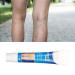 Varicose Veins Cream | Eliminate Spider Veins & Soothing Treatment - International Shipping - Buy Online on GoSupps.com