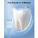 MySmile Teeth Whitening Kit with LED Light - Fast Non-Sensitive Whitener with 3 Carbamide Peroxide Gels - Remove Stains from Coffee, Smoking, Wine & Food - 10 Min Treatment - Buy Online on GoSupps.com