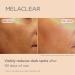 ISDIN Melaclear Dark Spot Correcting Serum - Vitamin C & Phytic Acid for Sensitive Skin - Buy Online on GoSupps.com