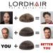 Lordhair Knotless Toupet for Men - 8x10 Inch Skin Top Human Hair System | Light Medium Density - Buy Online on GoSupps.com