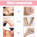 Buy Lymphology Complex Body Oil | Rose Stem Flower Oil for Lymphatic Drainage | 2 PCs | All Skin Types | International Shipping Available - Buy Online on GoSupps.com