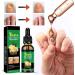  Cymwer Ginger Nail Serum 30ml Natural Growth Oil Strengthener for Fortified Nails Moisturizing and Revitalizing Care - Buy Online on GoSupps.com