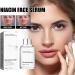 Niacinamide Freckles Removal Serum Niacinamide Spots Removal Serum Niacinamide Serum Nicotinamide Serum for Blemishes Niacinamide Serum for Face and Body for All Type Skin - Buy Online on GoSupps.com