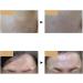 Led Masque Skincare Lightweight Skin Care LED for Face Care | LED Beauty Rechargeable LED Beauty for Travel Home - Buy Online on GoSupps.com