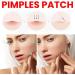 Acne Pimple Patch 5 Colors 200 Patches Star Pimple Patches Tea Tree Oil Witch Hazel & Centella Oil Hydrocolloid Acne Pimple Patches for Face Cute Zit Patches Pimple Stickers Acne Dots - Buy Online on GoSupps.com