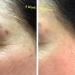 Dark Spot Remover for Face and Body - Fade Cream with B-White Peptide, Kojic Acid, Mulberry Extract, and Alpha Arbutin - Buy Online on GoSupps.com
