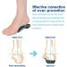 3/4 Plantar Fasciitis Insoles | High Arch Support Inserts for Foot Pain Relief | Metatarsal Support for Flat Feet | Medium Size for Men & Women - Buy Online on GoSupps.com