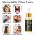 Biotin Thickening Herbal Serum - Fast Hair Growth Essence Oil | Prevent Hair Loss & Thinning for All Hair Types (3 PCs) - Buy Online on GoSupps.com